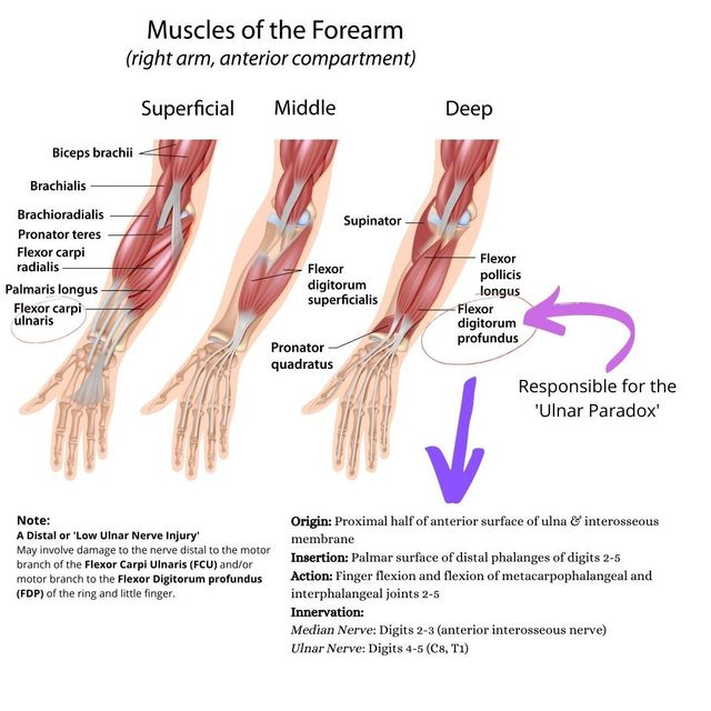 Ulnar forearm outlet pain